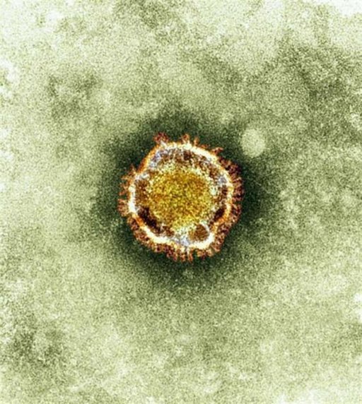 WHO cảnh báo nguy cơ bùng phát đại dịch do virus corona